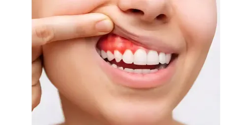 meslhy1987.hocoos.com