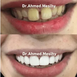 meslhy1987.hocoos.com