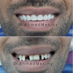 meslhy1987.hocoos.com